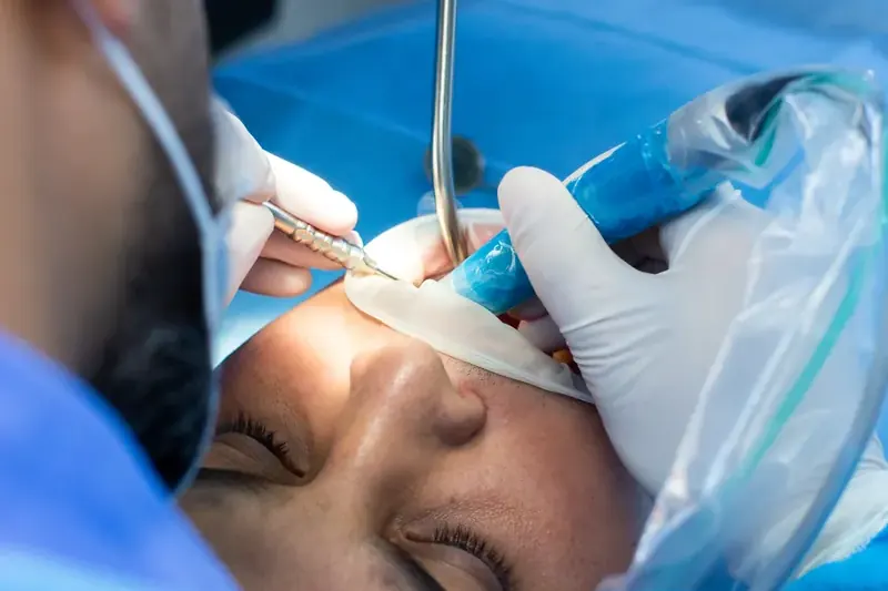 Tratamento de Canal em Taguatinga - Clínica OdontoLinea