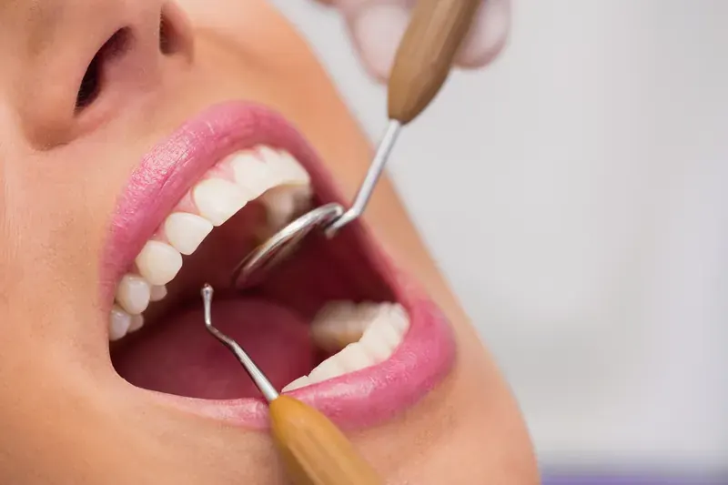 Periodontia em Taguatinga - Clínica OdontoLinea